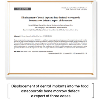 Displacement of dental implants into the focal osteoporotic bone marrow defect: a report of three cases